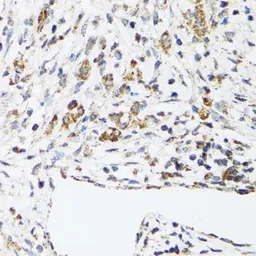 Anti-DHRS2 antibody used in IHC (Paraffin sections) (IHC-P). GTX33152