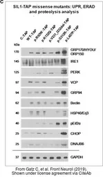 Anti-DNAJB6 antibody used in Western Blot (WB). GTX33160