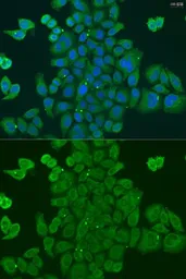 Anti-DPM1 antibody used in Immunocytochemistry/ Immunofluorescence (ICC/IF). GTX33163