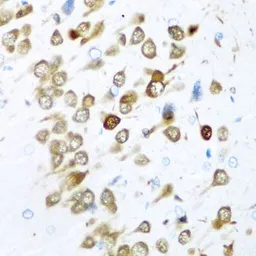 Anti-HuC antibody used in IHC (Paraffin sections) (IHC-P). GTX33177
