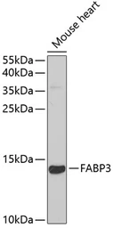Anti-FABP3 antibody used in Western Blot (WB). GTX33190