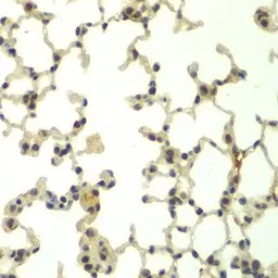 Anti-FBXW11 antibody used in IHC (Paraffin sections) (IHC-P). GTX33193
