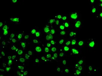 Anti-GABPB1 antibody used in Immunocytochemistry/ Immunofluorescence (ICC/IF). GTX33210
