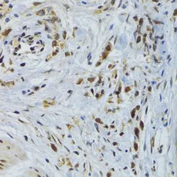 Anti-GABPB1 antibody used in IHC (Paraffin sections) (IHC-P). GTX33210