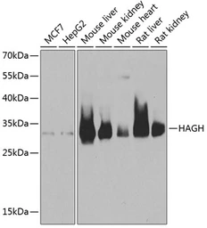 Anti-HAGH antibody used in Western Blot (WB). GTX33234