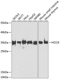 Anti-HCCS antibody used in Western Blot (WB). GTX33236