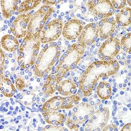 Anti-HMGCL antibody used in IHC (Paraffin sections) (IHC-P). GTX33242