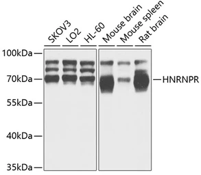 Anti-hnRNP R antibody used in Western Blot (WB). GTX33244