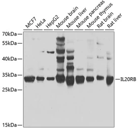 Anti-IL20RB antibody used in Western Blot (WB). GTX33262