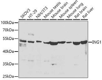 Anti-ING1 antibody used in Western Blot (WB). GTX33265