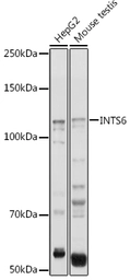 Anti-INTS6 antibody used in Western Blot (WB). GTX33271