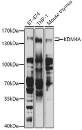 Anti-KDM4A antibody used in Western Blot (WB). GTX33282