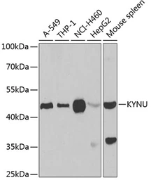 Anti-KYNU antibody used in Western Blot (WB). GTX33291
