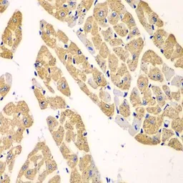 Anti-KYNU antibody used in IHC (Paraffin sections) (IHC-P). GTX33291