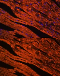 Anti-LDB3 antibody used in IHC (Paraffin sections) (IHC-P). GTX33294