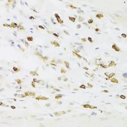 Anti-LSP1 antibody used in IHC (Paraffin sections) (IHC-P). GTX33304