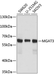 Anti-MGAT3 antibody used in Western Blot (WB). GTX33317