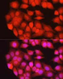 Anti-MURF1 antibody used in Immunocytochemistry/ Immunofluorescence (ICC/IF). GTX33334