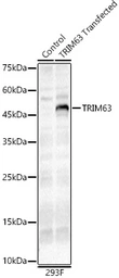 Anti-MURF1 antibody used in Western Blot (WB). GTX33334