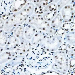 Anti-MYST2 antibody used in IHC (Paraffin sections) (IHC-P). GTX33341