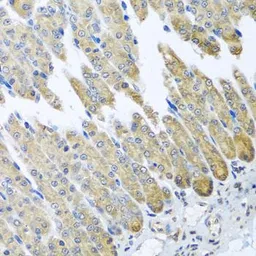 Anti-NDUFB10 antibody used in IHC (Paraffin sections) (IHC-P). GTX33350