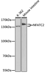 Anti-NFAT1 antibody used in Western Blot (WB). GTX33354
