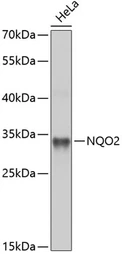 Anti-NQO2 antibody used in Western Blot (WB). GTX33363
