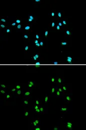 Anti-NR5A2 antibody used in Immunocytochemistry/ Immunofluorescence (ICC/IF). GTX33366