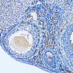 Anti-OGDH antibody used in IHC (Paraffin sections) (IHC-P). GTX33374