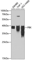 Anti-PBK antibody used in Western Blot (WB). GTX33388