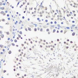 Anti-PBK antibody used in IHC (Paraffin sections) (IHC-P). GTX33388