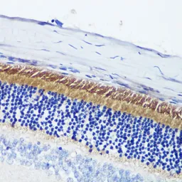 Anti-PDE6B antibody used in IHC (Paraffin sections) (IHC-P). GTX33395