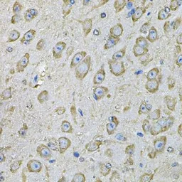 Anti-PDIA6 antibody used in IHC (Paraffin sections) (IHC-P). GTX33397