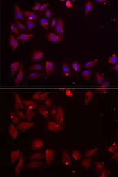 Anti-PDXK antibody used in Immunocytochemistry/ Immunofluorescence (ICC/IF). GTX33400