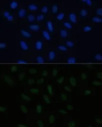 Anti-PELP1 antibody used in Immunocytochemistry/ Immunofluorescence (ICC/IF). GTX33402