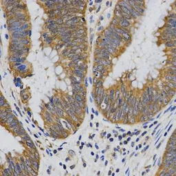 Anti-PIBF1 antibody used in IHC (Paraffin sections) (IHC-P). GTX33409