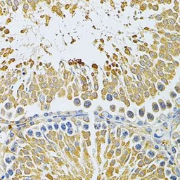 Anti-PIBF1 antibody used in IHC (Paraffin sections) (IHC-P). GTX33409