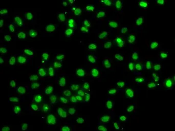 Anti-PMS2 antibody used in Immunocytochemistry/ Immunofluorescence (ICC/IF). GTX33418