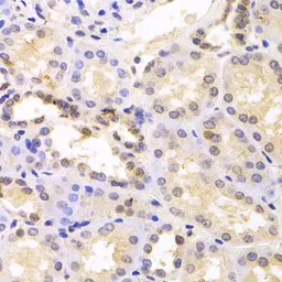Anti-PSMC6 antibody used in IHC (Paraffin sections) (IHC-P). GTX33436