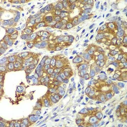 Anti-QARS antibody used in IHC (Paraffin sections) (IHC-P). GTX33449