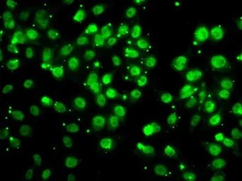 Anti-QKI antibody used in Immunocytochemistry/ Immunofluorescence (ICC/IF). GTX33450