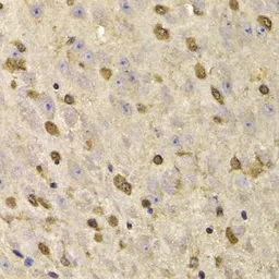Anti-QKI antibody used in IHC (Paraffin sections) (IHC-P). GTX33450