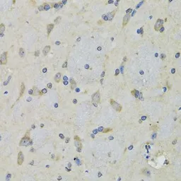 Anti-RAE1 antibody used in IHC (Paraffin sections) (IHC-P). GTX33456