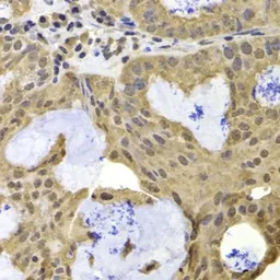 Anti-RAP1 antibody used in IHC (Paraffin sections) (IHC-P). GTX33458