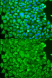 Anti-SGCE antibody used in Immunocytochemistry/ Immunofluorescence (ICC/IF). GTX33494