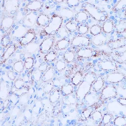 Anti-SIRT3 antibody used in IHC (Paraffin sections) (IHC-P). GTX33499