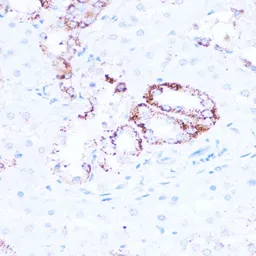 Anti-SIRT3 antibody used in IHC (Paraffin sections) (IHC-P). GTX33499