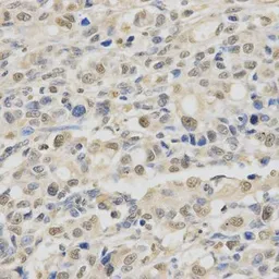 Anti-SPHK1 antibody used in IHC (Paraffin sections) (IHC-P). GTX33516