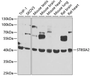 Anti-ST8SIA2 antibody used in Western Blot (WB). GTX33522