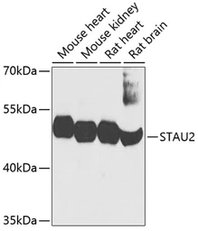 Anti-STAU2 antibody used in Western Blot (WB). GTX33526